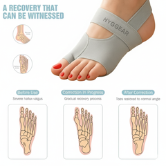 HYGGEAR Big Toe Bunion (Hallux Valgus) Corrector for Men and Women