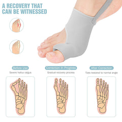 HYGGEAR BIG TOE BUNION (HALLUX VALGUS) CORRECTOR